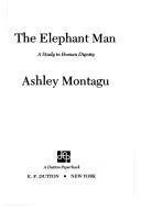 The elephant man